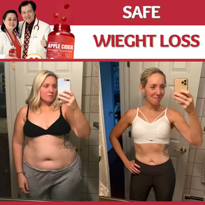 Oem/ODM nhãn hiệu riêng cung cấp Nhà máy sản phẩm tự nhiên hign chất lượng <span class=keywords><strong>Apple</strong></span> <span class=keywords><strong>Cider</strong></span> Vinegar Gummies cho cơ thể hình - Product Image 5