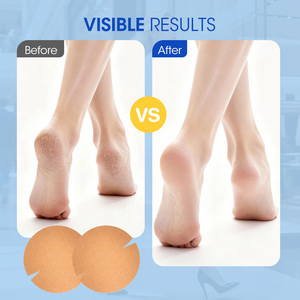 Parches <span class=keywords><strong>de</strong></span> Talón Cómodos con Capa Protectora <span class=keywords><strong>de</strong></span> Material <span class=keywords><strong>de</strong></span> Algodón para Alivio Instantáneo del Dolor y Protección Durante Todo el Día - Product Image 4