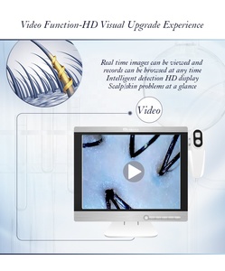 15.5 Inch HD Display With 2 Detector Portable Scalp Dandruff Damaged Skin Analysis Hair Machine Scalp Camera 32GB RAM - Product Image 2