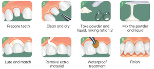 Semen Tipe 1 Ionomer <span class=keywords><strong>Luting</strong></span> Kaca Kualitas Tinggi Sangat Besar dengan Kekuatan Ikatan Tinggi - Product Image 4