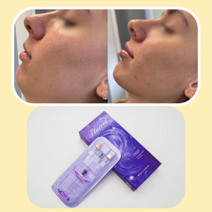 Production personnalisée en lot, combleur profond qui allonge le menton et sculpte les contours du visage, livraison gratuite <span class=keywords><strong>des</strong></span> produits - Product Image 2