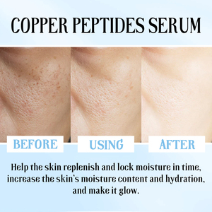 Suero Original de Fábrica en Stock ODM OEM 30ml Antiarrugas Reparador de Barrera Cutánea Reafirmante con Péptido de Cobre GHK-Cu para el Rostro - Product Image 5