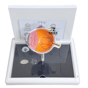 Modèle d'enseignement médical en PVC de l'anatomie de l'œil humain pour la cataracte - Product Image 2
