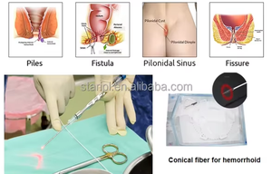 Láser de Diodo para Fístula Anal <span class=keywords><strong>y</strong></span> <span class=keywords><strong>Hemorroides</strong></span> 1470nm 980nm Medicina para <span class=keywords><strong>Hemorroides</strong></span> Tratamiento de <span class=keywords><strong>Hemorroides</strong></span> Láser de Proctología - Product Image 3