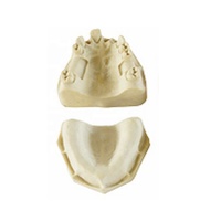 Implant dentaire Mandibule Pratique Dents Modèle Implant Chirurgie Formation Modèle