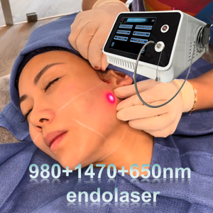 Equipo de Endoláser de 980 1470nm para Reducción de Bolsas en los Ojos, Celulitis, Moldeamiento Corporal, Lipólisis/Liposucción, Pérdida de Peso, Estimulación de la Regeneración de Colágeno - Product Image 1