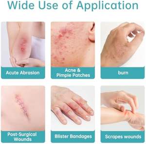 Apósito hidrocoloide en rollo impermeable, de tamaño adaptable, con adhesivo de fácil desgarro, estéril, certificado CE, para el cuidado de heridas, acné, quemaduras y ampollas. - Product Image 4