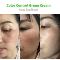Crème de contrôle de la pigmentation post-procédure OEM, éliminateur de mélasma et de HPI, prévention du recul pour le traitement et le soin de l'hyperpigmentation du visage