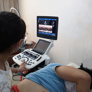 Équipement médical Longermay Échographie <span class=keywords><strong>Doppler</strong></span> couleur portable Échographie <span class=keywords><strong>Doppler</strong></span> portable - Product Image 5