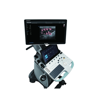 Sonoscape ProPet 70 <span class=keywords><strong>prix</strong></span> de gros <span class=keywords><strong>machine</strong></span> à ultrasons vétérinaire <span class=keywords><strong>3D</strong></span> 4D couleur doppler Scanner à ultrasons numérique pour vétérinaire - Product Image 2