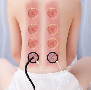 Nuevas Ventosas de Succión Fuerte Portátiles para Terapia de Masaje, Ventosas de Plástico (PC AS) para Masaje Facial y Corporal, 6 Unidades - Product Image 5