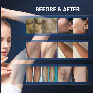 Appareil <span class=keywords><strong>de</strong></span> beauté laser diode vertical KES 808, épilation indolore, machine d'épilation au laser portable, prix - Product Image 5