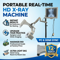 Appareil de radiographie vétérinaire portable numérique, fluoroscope vétérinaire, machine de radiographie vétérinaire