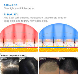 Helm penumbuh rambut Laser terapi, helm penumbuh rambut Laser terapi-650nm, Laser dingin + Kombo inframerah - Product Image 6
