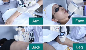 Máquina de depilación láser de diodo de 3 ondas profesional 1064nm 808nm 755nm Depilación con sistema de refrigeración Depilación para hombres y mujeres - Product Image 6