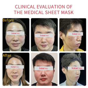 Feuille de masque facial de haute qualité hydratant le pansement médical d'hyaluronate de sodium - Product Image 6