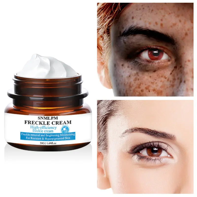Whitening and Freckle Removing Cream Chloasma Freckle Removing and Skin Firming Face Cream