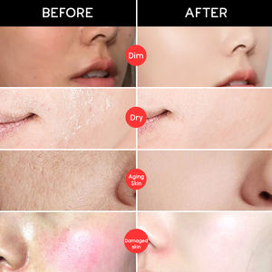 プライベートラベルホワイトニングダークスポットリムーバーフェイスボディモイスチャライジングコウジ酸治療ビタミンC注入フェイシャルケアセットアンチエイジング - Product Image 3