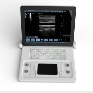 Système d'échographe portable noir et blanc pour ordinateur portable - Product Image 2