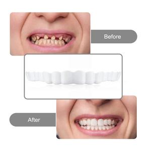Faccette Dentali Artificiali Superiori in Silicone di Alta Qualità Forniture per Impianti Dentali Apparecchio Sbiancante con Custodia per Sbiancamento Denti - Product Image 4