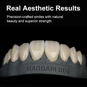 Matériaux d'implants dentaires en verre-céramique Ownsmile C14, réparation immédiate, frittage, cristallisation, blocs dentaires, disilicate de lithium - Product Image 6