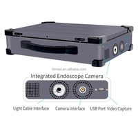 Système de caméra endoscopique médicale portable HD – Unité d'endoscopie ORL, urétéroscope, gastroscope, colonoscope, laparoscope