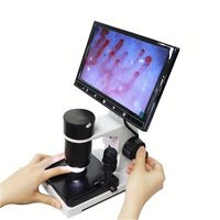 Hi-Tech Optical Instrument Blood test Electron Microscope Machine Blood Vessel Microscope Blood Microcirculation Test Analyzer
