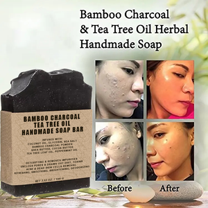<span class=keywords><strong>Savon</strong></span> Corporel Éclaircissant au <span class=keywords><strong>Charbon</strong></span> de Bambou Activé et Huile de Tea Tree, <span class=keywords><strong>Savon</strong></span> Visage Bio à la Noix de Coco, <span class=keywords><strong>Savon</strong></span> Noir Marocain Anti-Bactérien Contre le Mélasma - Product Image 2
