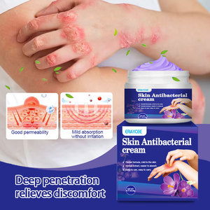 Crema de 20g para Aliviar Picaduras de Mosquitos, Psoriasis, Dermatitis, Eccema, Cuidado de la Piel, Antiprurito Efectivo - Product Image 5
