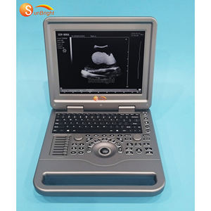Máquina <span class=keywords><strong>de</strong></span> Ultrasonido SUN-806A <span class=keywords><strong>de</strong></span> Visualización Precisa al <span class=keywords><strong>Precio</strong></span> Más Bajo, Fabricada en China, Rentable para Clínicas Generales - Product Image 3