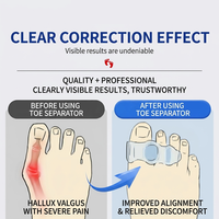 Separadores de Dedos de Silicona para Mujeres y Hombres, Duraderos, Transpirables, Correctores de Juanetes, Enderezadores de Dedos Superpuestos, Hallux Valgus