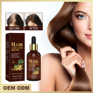 Aceite para el Crecimiento <span class=keywords><strong>del</strong></span> <span class=keywords><strong>Cabello</strong></span> 100% Natural, Orgánico y Vegano al por Mayor, Suero para el Crecimiento <span class=keywords><strong>del</strong></span> <span class=keywords><strong>Cabello</strong></span> de Marca Privada - Product Image 2