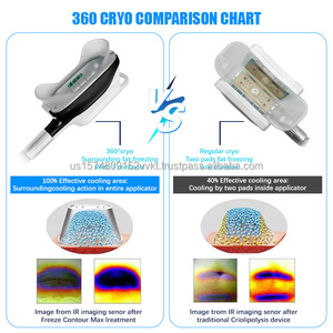 เครื่องลดสัดส่วนด้วยความเย็น 9-in-1  วัสดุสแตนเลส ABS สำหรับการบำบัดด้วยความเย็น ปรับรูปร่าง และกระตุ้นระบบน้ำเหลือง - Product Image 5