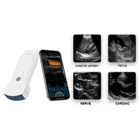 Sonda Konted C10RL 3 en 1 Ecógrafo Inalámbrico Escáner de Ultrasonido Portátil para Sistema IOS/Android/Windows con MDR CE