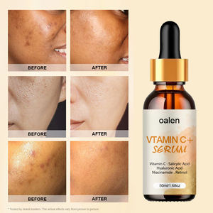 Suero de Vitamina C Orgánico de Marca Privada para el Rostro, Ingredientes Naturales, Antiarrugas, Piel Radiante - Product Image 4