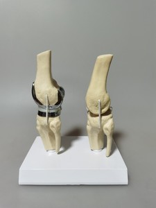Modelo de <span class=keywords><strong>Rodilla</strong></span> Doble Artificial de Tamaño Real, Modelo de Demostración de Anatomía de <span class=keywords><strong>Rodilla</strong></span> Humana para Enseñanza y Entrenamiento Médico - Product Image 3