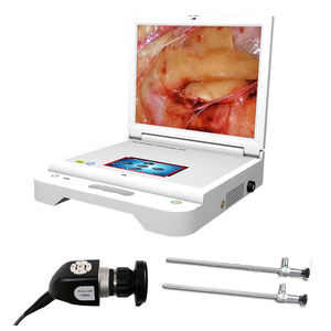 Microscopio Digital Médico Portátil, Cámara para Cirugía Endoscópica Funcional de Senos Paranasales - Product Image 1