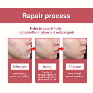 Cerotto per brufoli idrocolloidi a forma di artiglio d'orso colorato personalizzato per la cura della pelle con <span class=keywords><strong>Acne</strong></span> carine macchie - Product Image 6