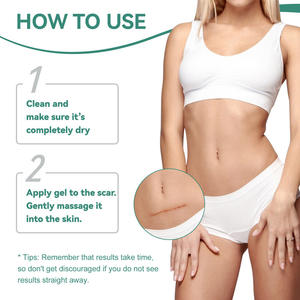 YURHERSU 외과 화상 여드름 흉터 제거 크림 여드름 제거 얼굴 젤 배 턱 조임 스트레치 마크 제거 크림 - Product Image 6