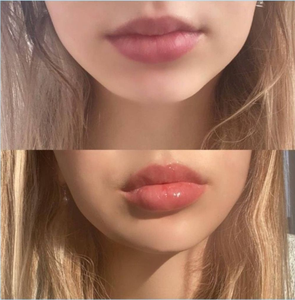 Voluminizador <span class=keywords><strong>de</strong></span> <span class=keywords><strong>Labios</strong></span> <span class=keywords><strong>de</strong></span> Alta Eficacia, Aumenta el Volumen <span class=keywords><strong>de</strong></span> tus <span class=keywords><strong>Labios</strong></span>, Bajo MOQ, Brillo <span class=keywords><strong>de</strong></span> <span class=keywords><strong>Labios</strong></span> Vegano <span class=keywords><strong>de</strong></span> Lujo, Larga Duración, Marca Privada - Product Image 2