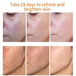 Creme Clareador Potente de Efeitos Fortes para <span class=keywords><strong>Remover</strong></span> Sinais Escuros, <span class=keywords><strong>Melasma</strong></span> e Pigmentos de Melaninana, Hidratante para Cuidado da Pele - Product Image 6