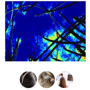 Analyseur de Cheveux et de Cuir Chevelu Portable AI avec Grand Écran – Vente en Gros Usine - Product Image 3