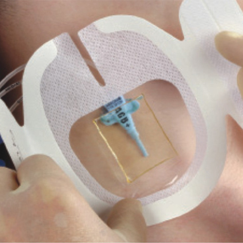 YAFHO Securefix I.V. and Catheter Dressing with CHG Pad