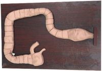 Simulateur de gros intestin Modèle d'entraînement à la coloscopie et à la sigmoïdoscopie avec caractéristiques de pathologie pour les sciences médicales