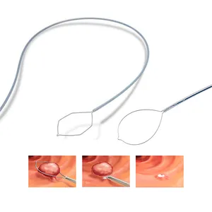 Bán Hot Gastroenterological Nội Soi Polypectomy Snare Y Tế Dùng Một Lần Polypectomy Snare