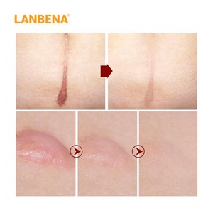 marcas eliminación crema embarazo cicatriz tratamiento de reparación Crema de Cara de piel suave cuerpo Dropshipping Exclusivo - Product Image 5