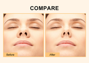 Férula Nasal Termoplástica de Grado Clínico 2026, Moldeable, Reutilizable, de Alta Elasticidad, Herramienta de Belleza Facial No Invasiva - Product Image 5