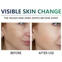 Offre Spéciale avancé rajeunissant pour la peau 40% 45% 50% Sérums pour le visage Peel adoucit les cicatrices blanchissant le sérum liquide pour le visage