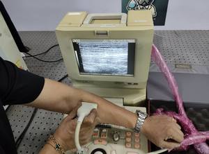 Mesin Ultrasound Medison SonoAce PICO Mycolor 202 Bekas dengan Probe Linear L5 9EC - Product Image 4