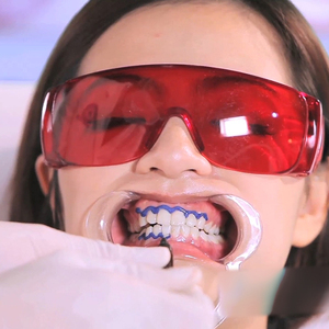 Set Completo <span class=keywords><strong>per</strong></span> Sbiancamento Dentale con Gel al Perossido al 38%HP, Barriera Gengivale e Balsamo Labbra <span class=keywords><strong>per</strong></span> Salone e Spa, Vendita all'Ingrosso - Product Image 4